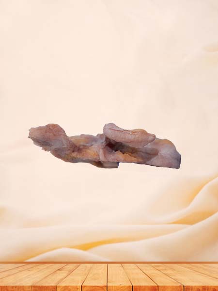 Soft Simulated Human Ileocecal Adenocarcinoma Pathology Model