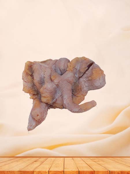 Soft Simulated Human Ileocecal Adenocarcinoma Pathology Model