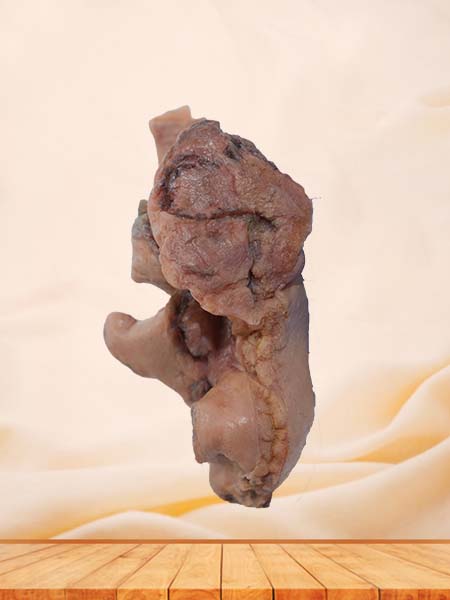 Soft Simulated Malignant Pleural Mesothelioma Pathology Specimen
