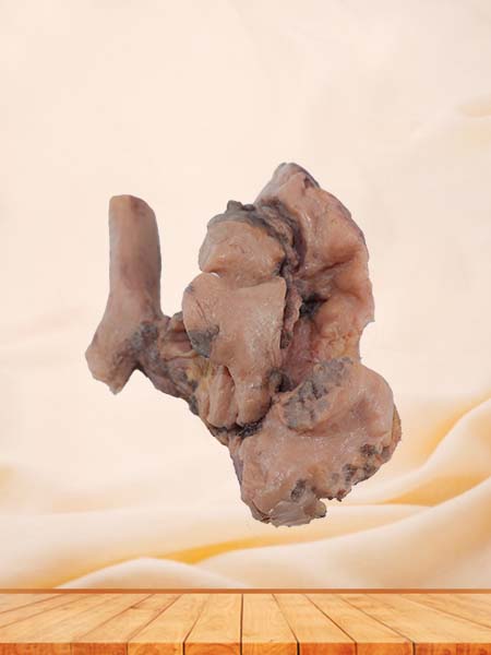 Soft Simulated Malignant Pleural Mesothelioma Pathology Specimen