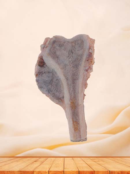 Soft Simulated Osteosarcoma Pathology Model