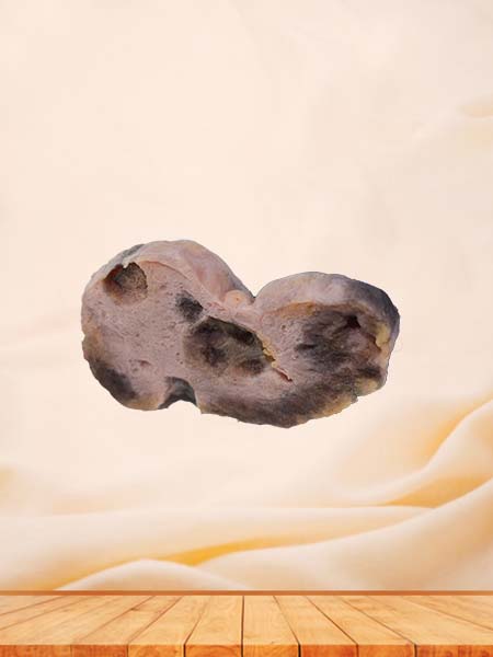 Soft Simulated Female Ovarian Cancer Model