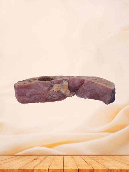 High Simulation Bile Duct Epithelial Liver Cancer Pathology Specimen