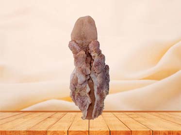 Esophageal Cancer Anatomy Model