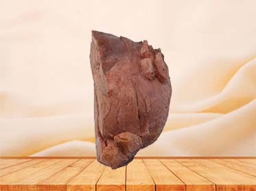Multiple Uterine Fibroids Anatomy Model