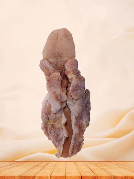 High Simulation Silicone Esophageal Cancer Model
