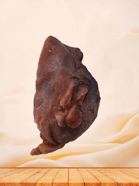 Soft Simulated Female Multiple Uterine Fibroids Anatomy Model