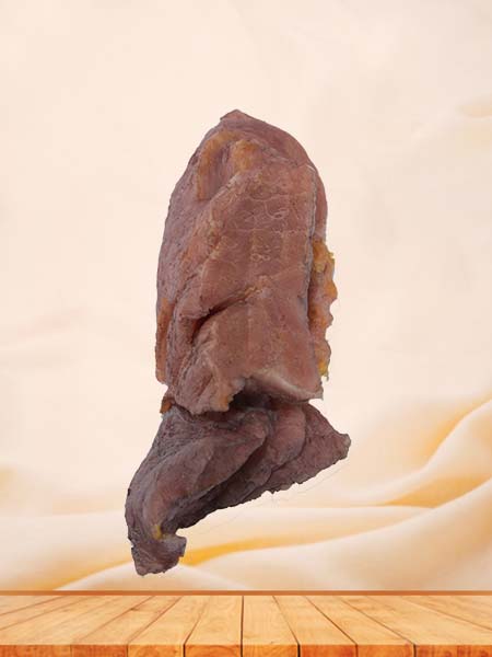 Soft Simulated Human Pulmonary Abscess Complicated by Pulmonary Carnification‌ Anatomy Model