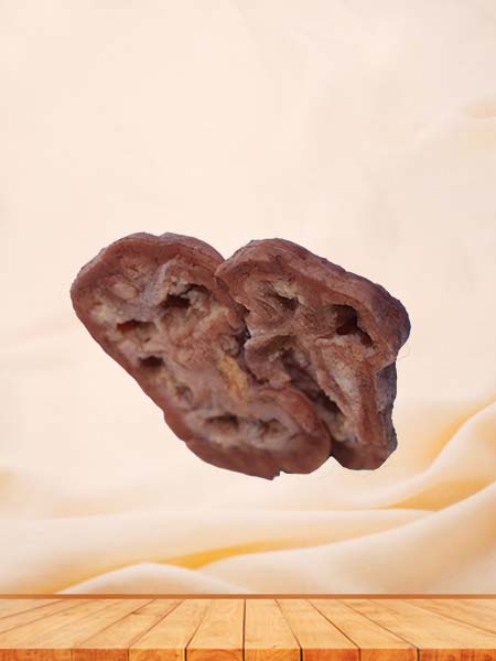 High Simulation Silicone Renal Tuberculosis Model