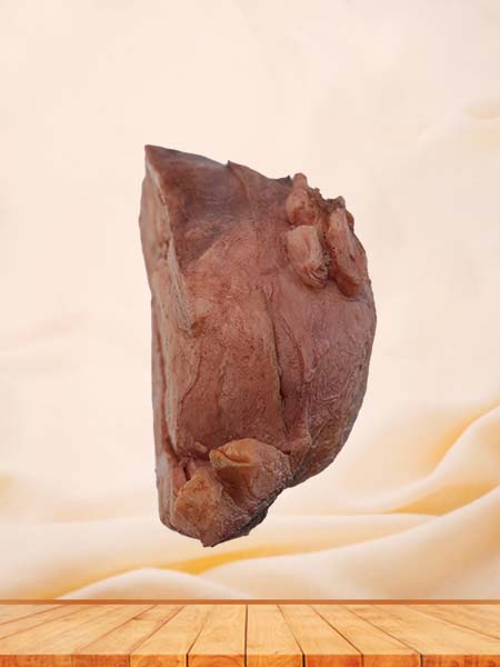 Soft Simulated Female Multiple Uterine Fibroids Anatomy Model