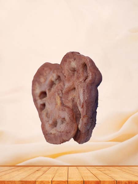 High Simulation Silicone Renal Tuberculosis Model