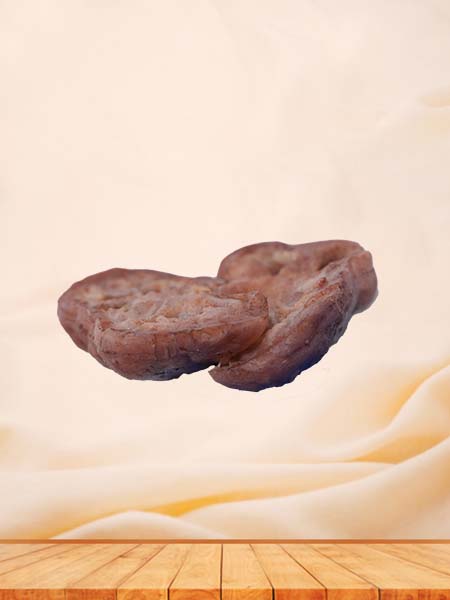 High Simulation Silicone Renal Tuberculosis Model