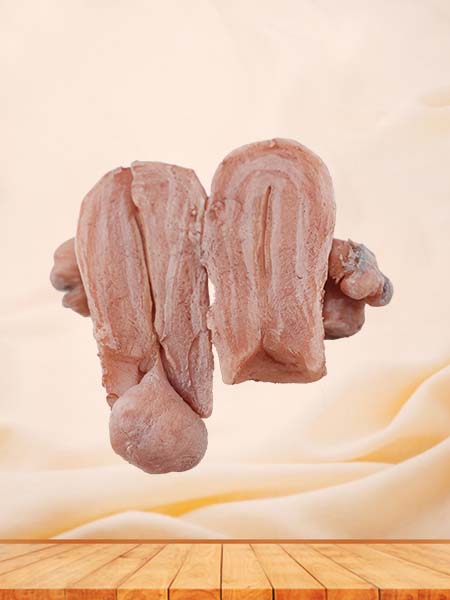 Soft Simulated Female Uterine Leiomyoma Model
