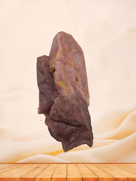 Soft Simulated Human Pulmonary Abscess Complicated by Pulmonary Carnification‌ Anatomy Model