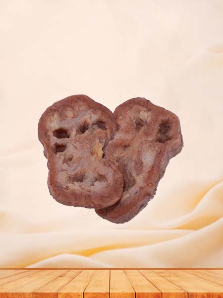 High Simulation Silicone Renal Tuberculosis Model